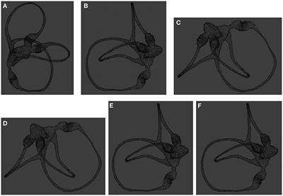 Simulation Study of BPPV Fatigability